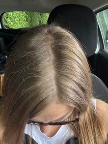 After - “Volví a ver crecer mi cabello donde antes se caía”