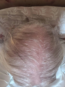 Before - Por fin noté una mejora real en mi cabello